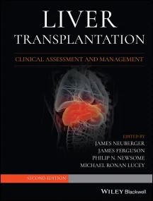 Liver Transplantation: Clinical Assessment and Man...