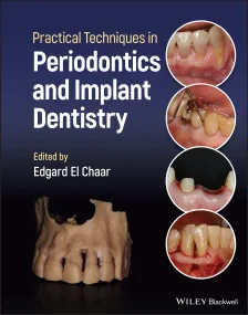 Practical Techniques in Periodontics and Implant D...