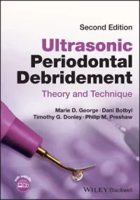 Ultrasonic Periodontal Debridement – Theory and Te...