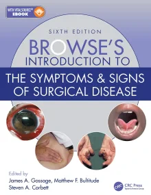Browse’s Introduction to the Symptoms & Signs of S...