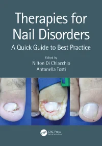 Therapies for Nail Disorders: A Quick Guide to Bes...