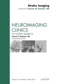 Stroke Imaging, An Issue of Neuroimaging Clinics