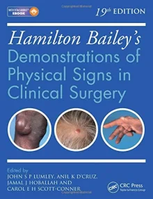 Hamilton Bailey s Physical Signs: Demonstrations o...