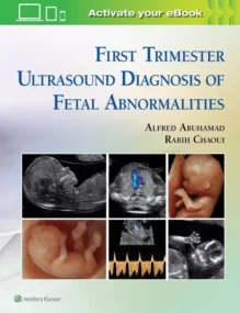 First Trimester Ultrasound Diagnosis of Fetal Abno...