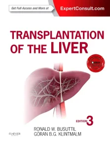 Transplantation of the Liver: Expert Consult - Onl...