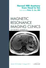 Normal MR Anatomy from Head to Toe, An Issue of Ma...