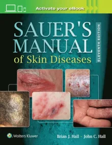 Sauer’s Manual of Skin Diseases, 11e 