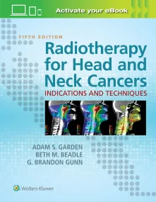 Radiotherapy for Head and Neck Cancers: Indication...