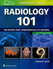 Radiology 101: The Basics and Fundamentals of Imag...