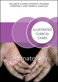 Dermatology: Illustrated Clinical Cases 