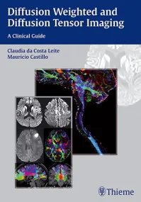  Diffusion Weighted and Diffusion Tensor Imaging: ...