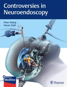 Controversies in Neuroendoscopy 