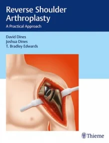 Reverse Shoulder Arthroplasty: A Practical Approac...