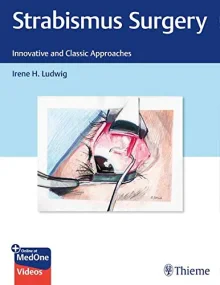 Strabismus Surgery: Innovative and Classic Approac...