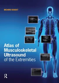 Atlas of Musculoskeletal Ultrasound of the Extremi...