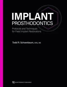 Implant Prosthodontics: Protocols and Techniques f...