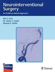 Neurointerventional Surgery: An Evidence-Based App...