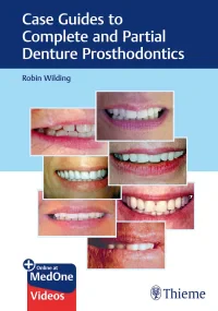 Case Guides to Complete and Partial Denture Prosth...