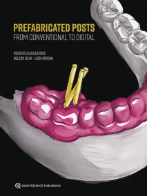 Prefabricated Posts: From Conventional to Digital