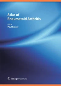 Atlas of Rheumatoid Arthritis 