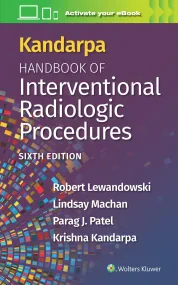 Kandarpa Handbook of Interventional Radiology