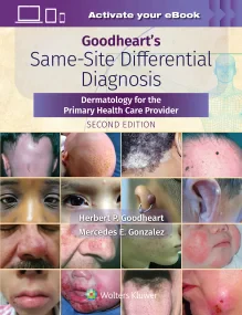 Goodheart’s Same-Site Differential Diagnosis Derma...
