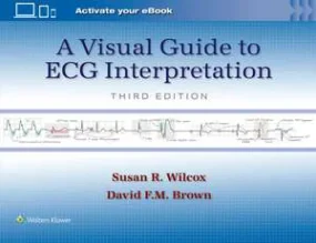 A Visual Guide to ECG Interpretation