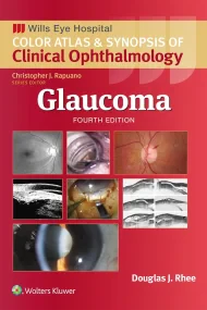 Glaucoma (Wills Eye Institute Atlas Series)