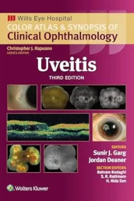 Uveitis. Third edition