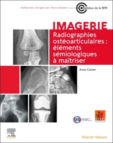 Radiographies ostéoarticulaires : éléments sémiolo...