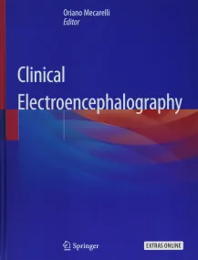 Clinical Electroencephalography