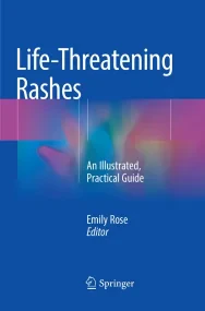 Life-Threatening Rashes: An Illustrated, Practical...