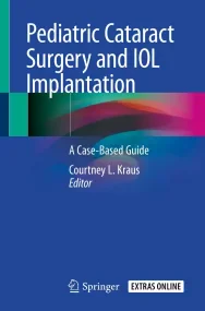 Pediatric Cataract Surgery and IOL Implantation: A...