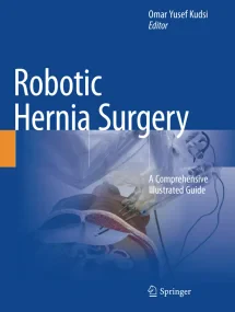 Robotic Hernia Surgery: A Comprehensive Illustrate...