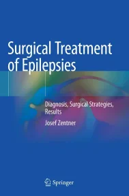 Surgical Treatment of Epilepsies