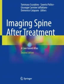 Imaging Spine After Treatment: A Case-based Atlas