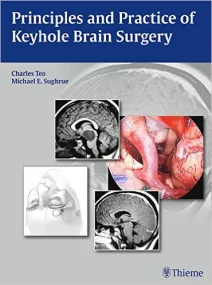 Principles and Practice of Keyhole Brain Surgery 1...