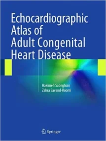 Echocardiographic Atlas of Adult Congenital Heart ...