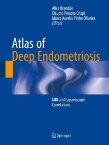 Atlas of Deep Endometriosis: MRI and Laparoscopic ...