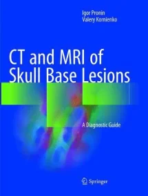 CT and MRI of Skull Base Lesions: A Diagnostic Gui...