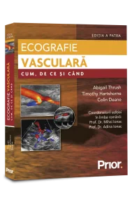 Ecografie vasculara. Cum, de ce si cand