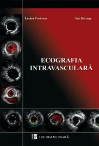 Ecografie intravasculara