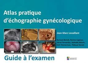 ATLAS PRATIQUE D'ECHOGRAPHIE GYNECOLOGIQUE - GUIDE...