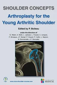 ARTHROPLASTY FOR THE YOUNG ARTHRITIC SHOULDER