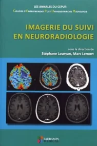 IMAGERIE DU SUIVI EN NEURORADIOLOGIE
