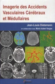 IMAGERIE DES ACCIDENTS VASCULAIRES CEREBRAUX ET ME...