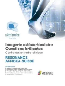 AFFIDEA IMAGERIE OSTEO-ARTICULAIRE QUESTIONS BRULA...