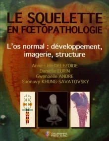 LE SQUELETTE EN FOETOPATHOLOGIE