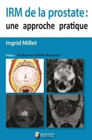 IRM DE LA PROSTATE