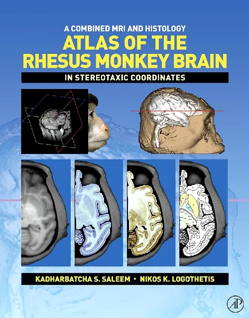 A Combined MRI and Histology Atlas of the Rhesus M...
